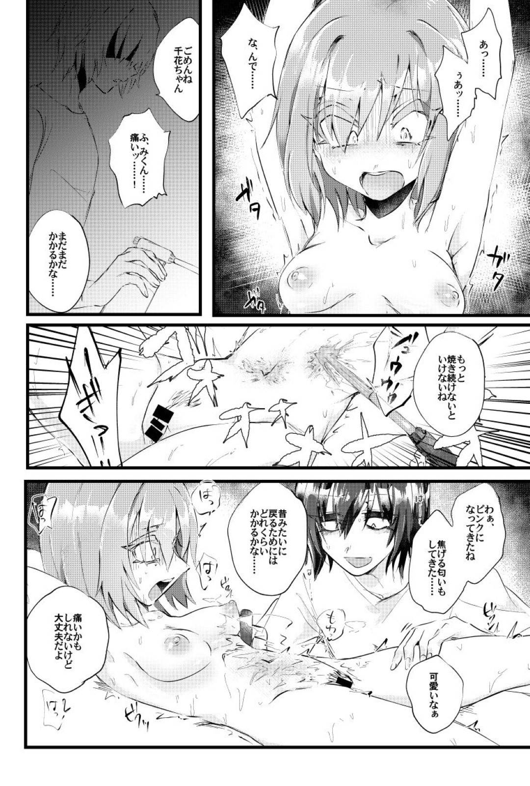 火事で火傷の傷を負ってしまった彼女のことを愛している男...彼女から火傷跡が消えてしまったのが許せず自分が火傷を負わせ強姦セックス【ねじやのひと：燃殻の恋】